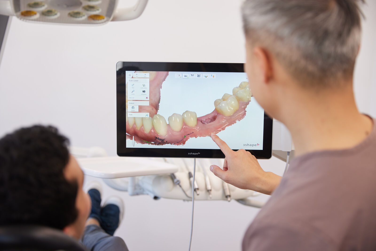 Healing phase — implant integrating with jaw bone